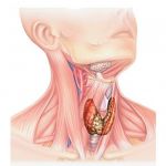 Операции опухолей щитовидной железы